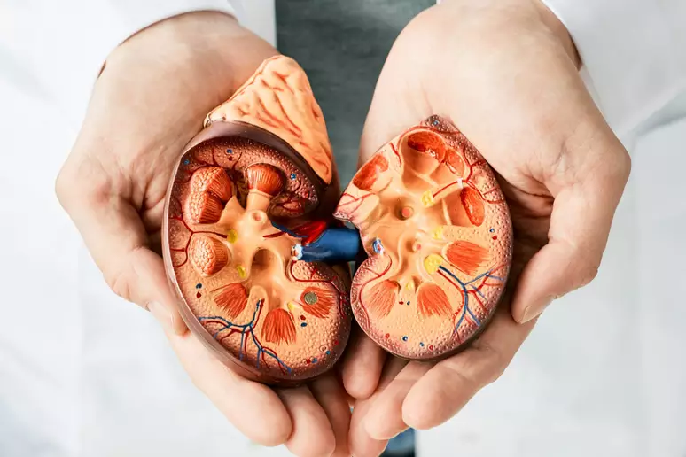 Cálculo Renal: Sintomas, Prevenção e Tratamento Moderno